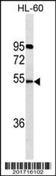 FKRP Antibody (C-term)