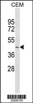 AGT Antibody (N-term)
