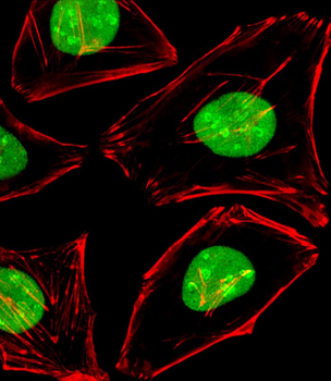 EWSR1 Antibody (C-term)