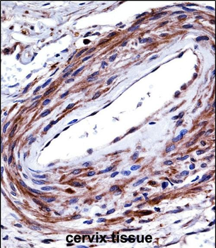 P2RX5 Antibody (C-term)