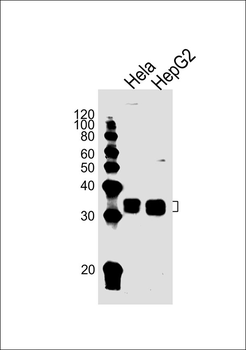 PPT1 Antibody