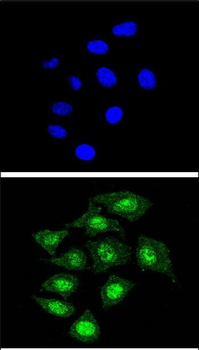 CBFB Antibody (Center)