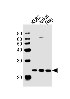 CBFB Antibody (Center)