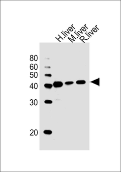 HAO1 Antibody (Center)