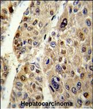 SERPINC1 Antibody (C-term)