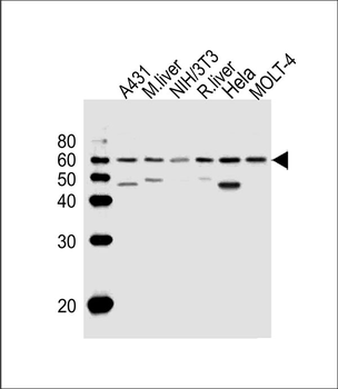 HSPD1 Antibody (C-term)