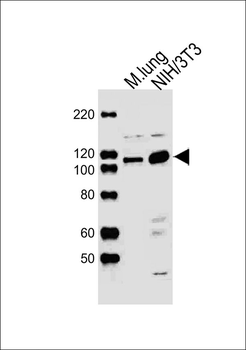 Mouse Ddr2 Antibody (Center)