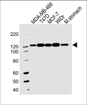 CDH1 Antibody