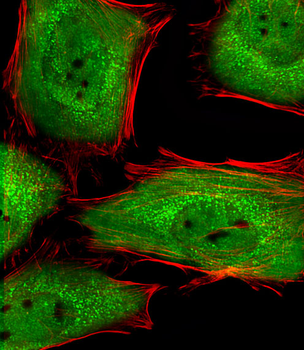 ACTL6A Antibody (Center)