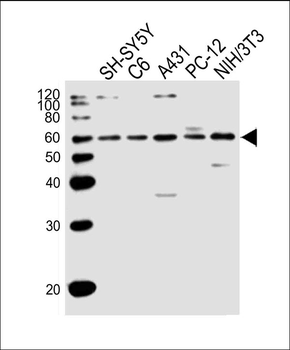 PAK1 Antibody (Center)