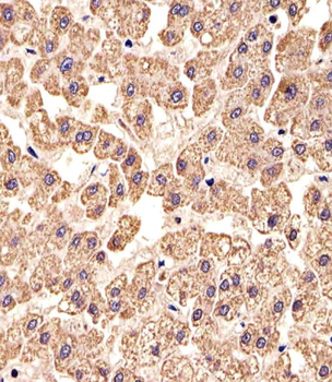CLN3 Antibody (Center)
