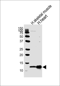 COX6A2 Antibody (Center)