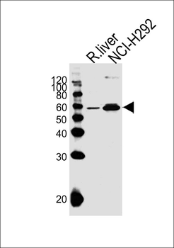 MCCC2 Antibody (Center)