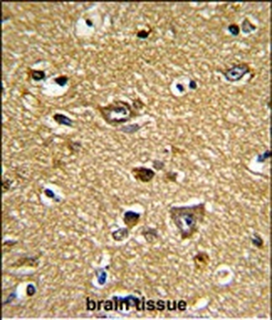PRDX2 Antibody (C-term)
