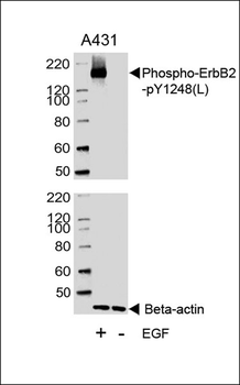 Phospho-ErbB2(Y1248) Antibody