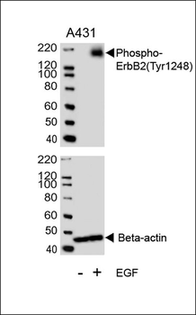 Phospho-ErbB2(Y1248) Antibody