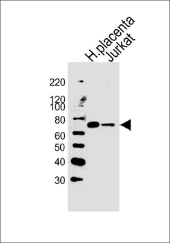 LIMK2 Antibody (C-term)