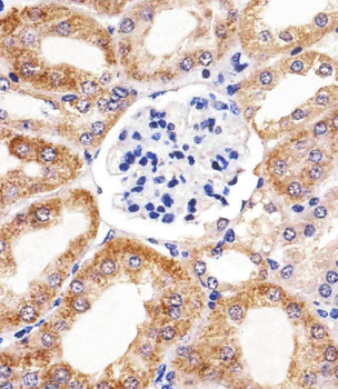 BCL10 Antibody
