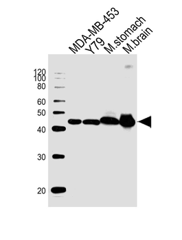 Creatine Kinase BB Antibody (Center)