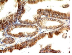 E-Cadherin / CD324 Antibody