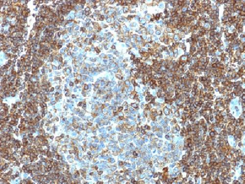 CD3e (T-Cell Marker) Antibody