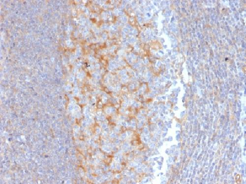 MRP1 / ABCC1 Antibody