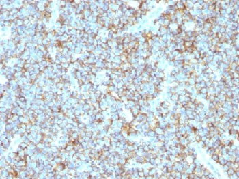 CD99 / MIC2 Antibody