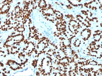 FOXA1 / HNF3A Antibody