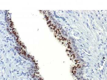 FOXA1 / HNF3A Antibody