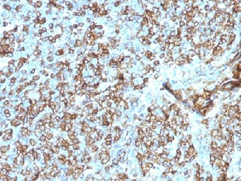 HLA-DP/-DQ/-DR (MHC II) Antibody
