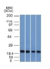 Ferritin, Light Chain (FTL) (Microglia Marker) Antibody