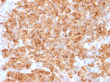 Chromogranin A / CHGA Antibody