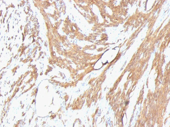 Actin, Muscle Specific (Muscle Cell Marker) Antibody - With BSA and Azide