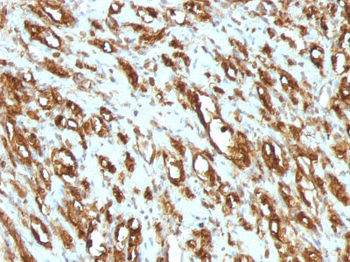 Actin, Muscle Specific (Muscle Cell Marker) Antibody - With BSA and Azide