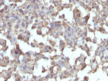 TNF-alpha (Tumor Necrosis Factor alpha) Antibody - With BSA and Azide