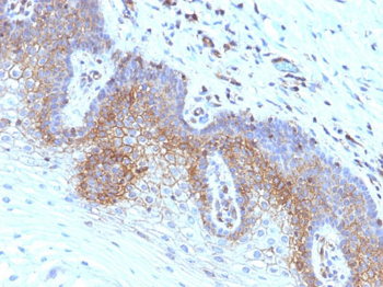 Beta-2 Microglobulin (Renal Failure & Tumor Marker) Antibody - With BSA and Azide