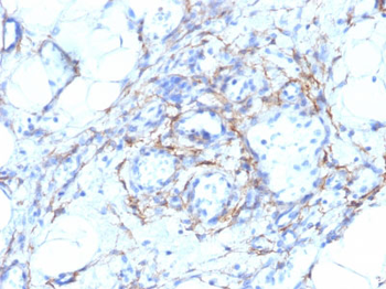 Smooth Muscle Myosin Heavy Chain (SM-MHC) (Leiomyosarcoma & Myoepithelial Cell Marker) Antibody - W