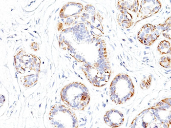 Smooth Muscle Myosin Heavy Chain (SM-MHC) (Leiomyosarcoma & Myoepithelial Cell Marker) Antibody - W