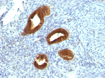 Cytokeratin 19 (KRT19) (Pancreatic Stem Cell Marker) Antibody - With BSA and Azide