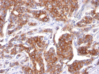 Cytokeratin 18 (KRT18) Antibody - With BSA and Azide