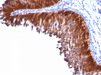 Cytokeratin 18 (KRT18) Antibody - With BSA and Azide