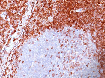 Bcl-2 (Apoptosis & Follicular Lymphoma Marker) Antibody - With BSA and Azide