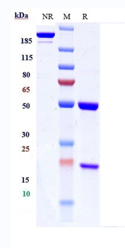 Anti-IGF1R / CD221 Reference Antibody