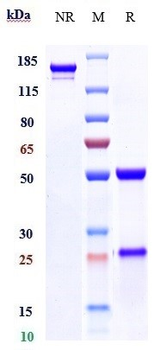 Anti-GOLM1 Reference Antibody