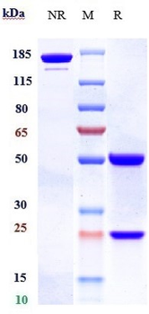 Anti-PCSK9 Reference Antibody (bococizumab)