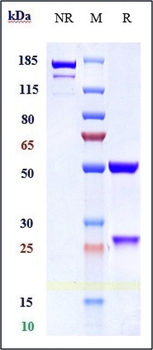 Anti-ALCAM / CD166 Reference Antibody (AT002)