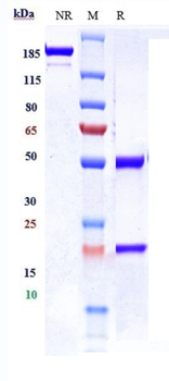 Anti-IGF1R / CD221 Reference Antibody (ganitumab)