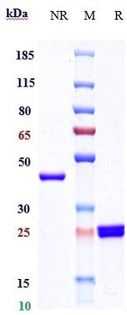 Anti-glycoprotein (GP) Iib / IIIa Reference Antibody (Abciximab)