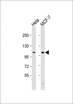 VLDLR Antibody (C-Term)
