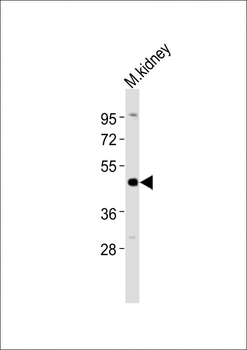 (Mouse) Ihh Antibody (N-term)